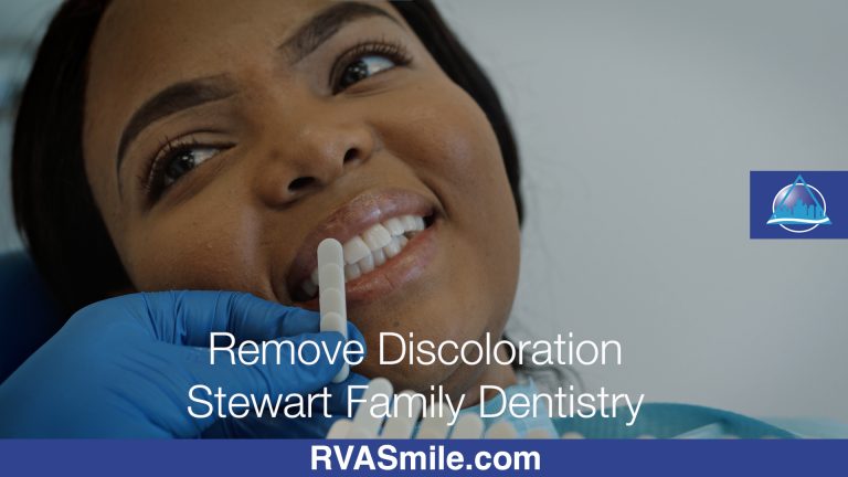 Top Benefits of Teeth Whitening – Part 1 – richmond VA Dentist